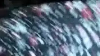 ألم الشرج في أعلى الصفحة الطاولة