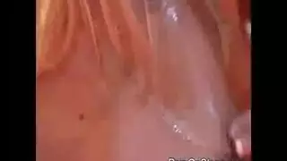 زراعةبطاطة