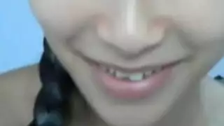 حليب الإحليل البظر