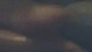 حسام ابو العطا لتجميل الثدي