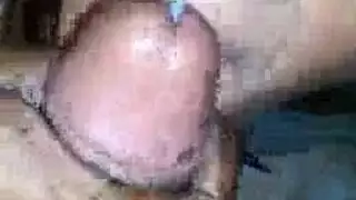 ابتلاع تجميع اشتم الإحليل